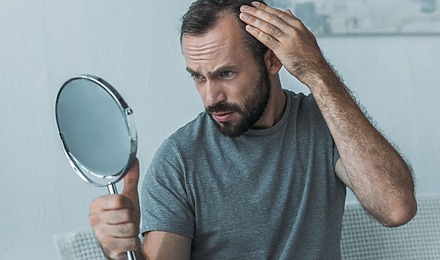 Hair Loss Symptoms