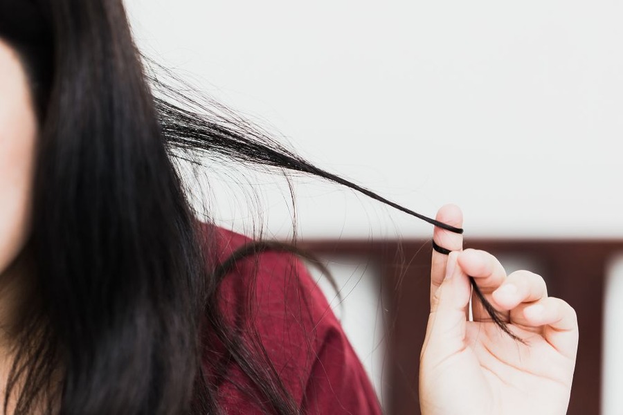 Trichotillomania Hair Regrowth Tips