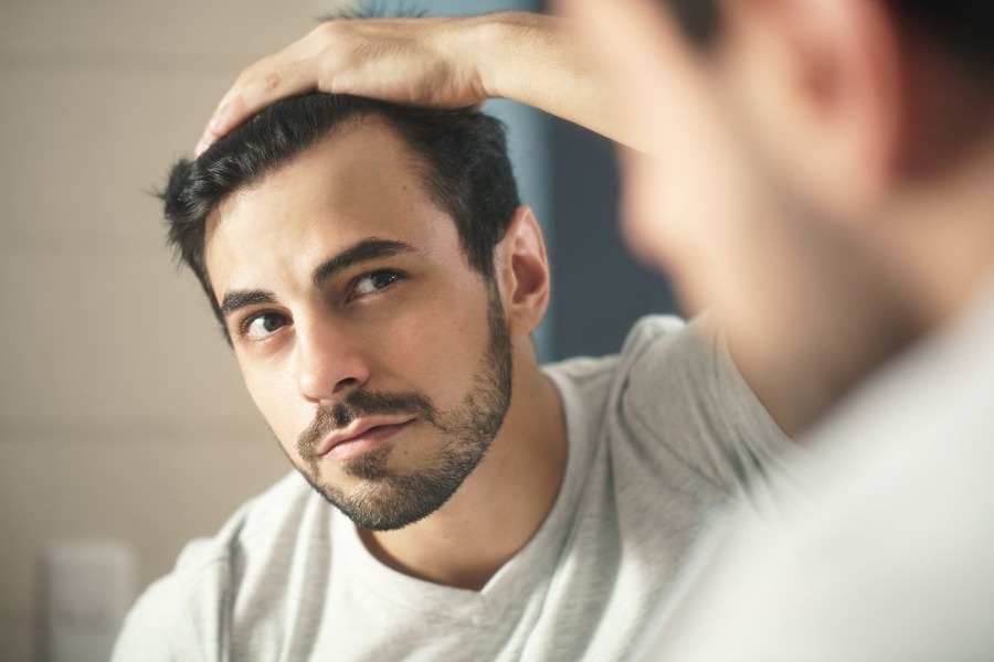 Second Hair Transplant