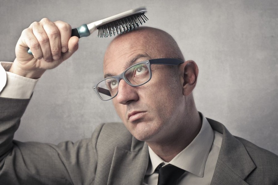 Can You Get A Hair Transplant If You Are Completely Bald