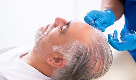 Hair Transplant Death Rate