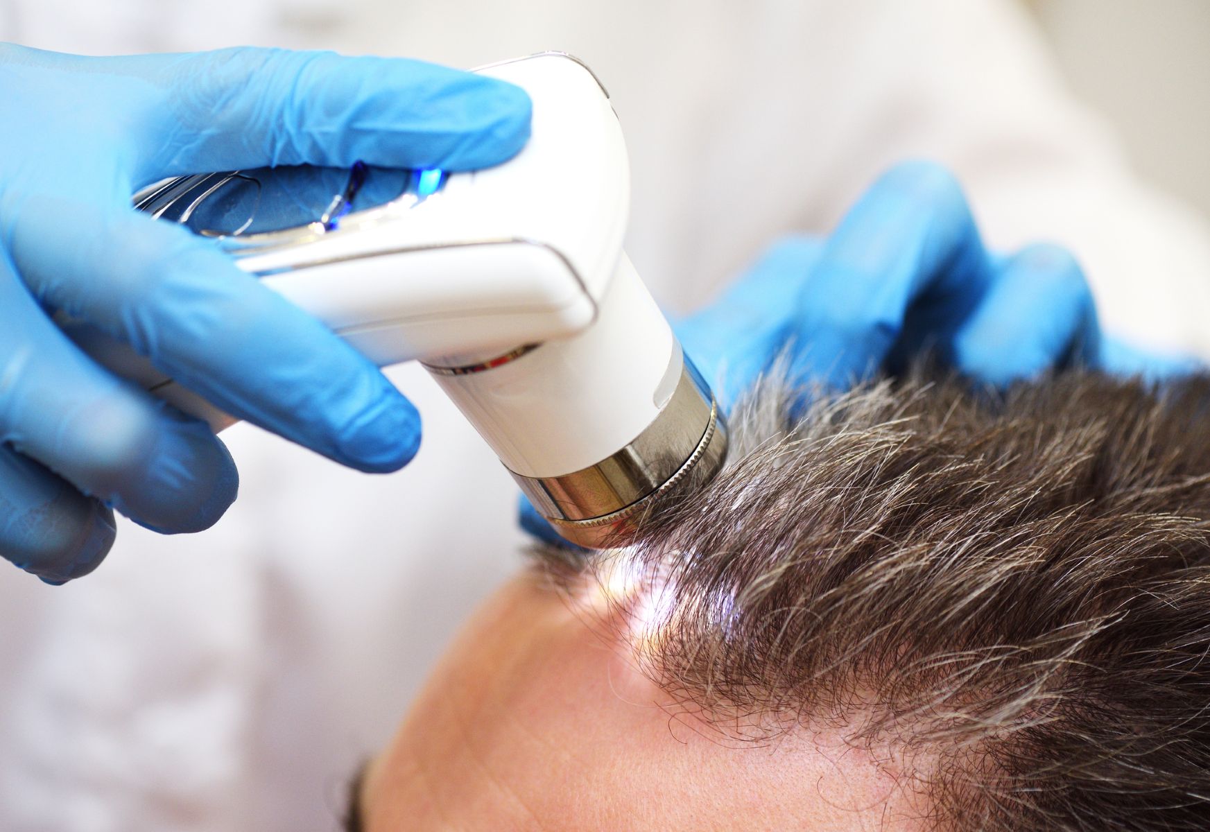 Patient examined by a trichologist