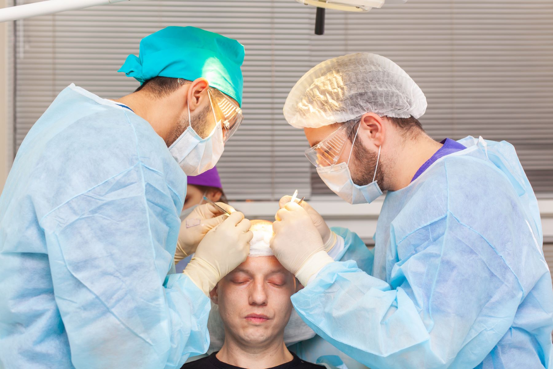 Hairline hair transplant