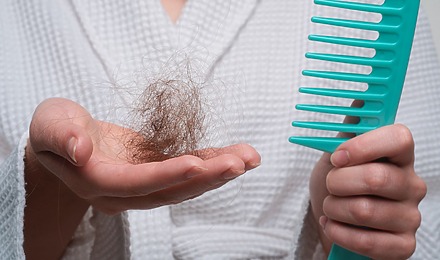 Hair Shedding Vs Hair Loss