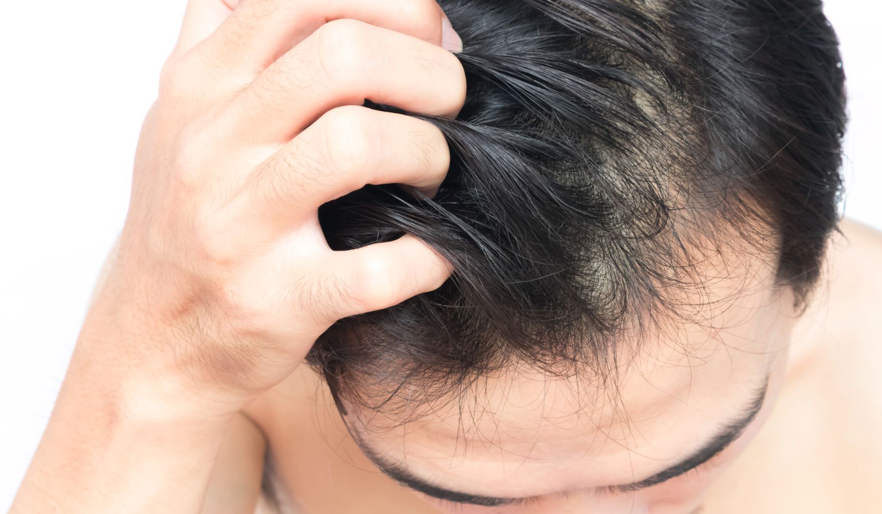 When Can I Rub My Head After a Hair Transplant?