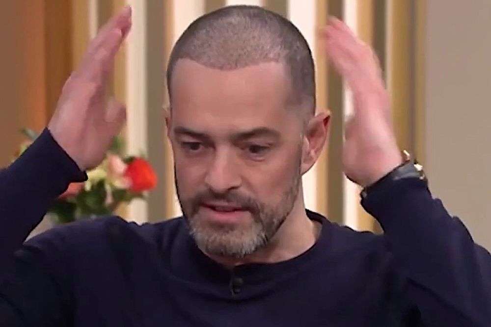 Lee Mead’s hair transplant recovery