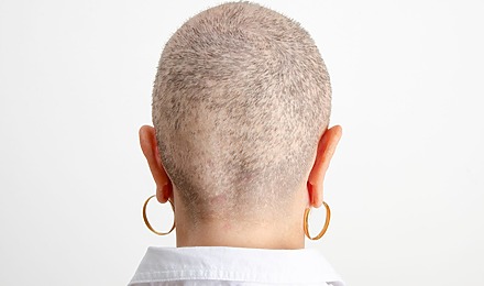 How To Stop Hair Loss At The Back Of The Head For Females