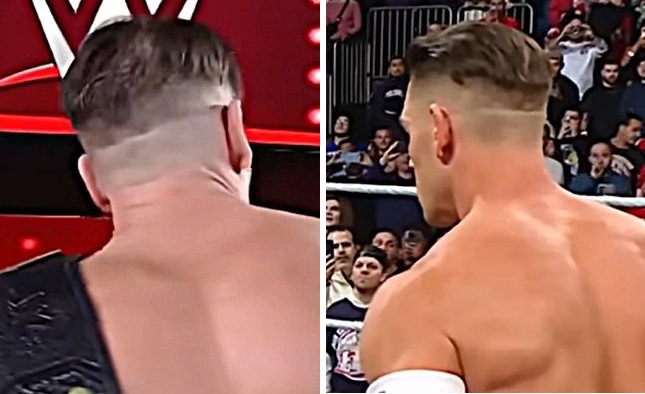 John Cena possible hair transplant scar