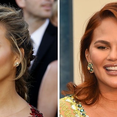 Chrissy Teigen before and after eyebrow transplant