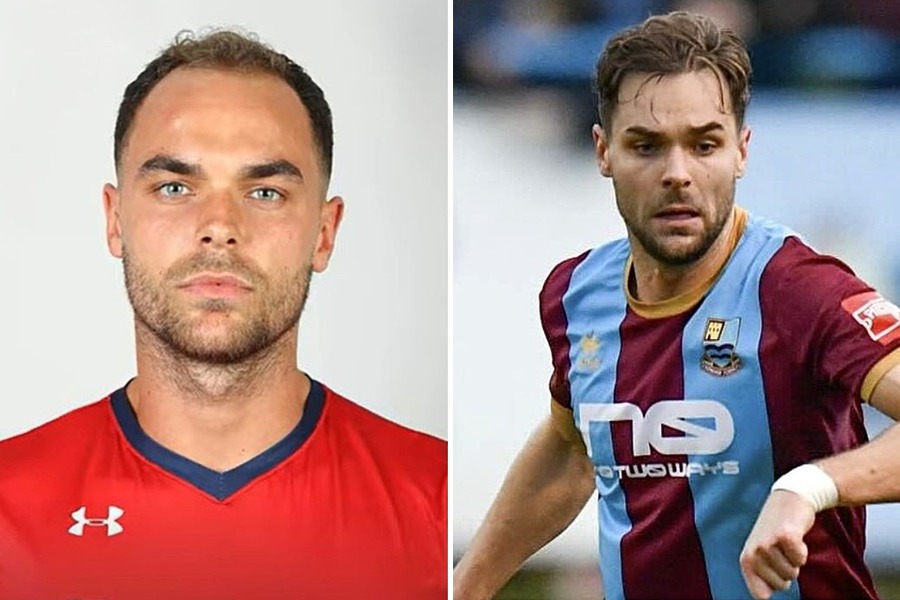 All About Harry Cooksley From Love Island’s Hair Transplant