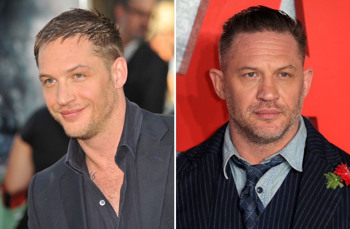 Left: Tom Hardy’s hairline in 2010. Right: Tom Hardy’s hairline in 2025.