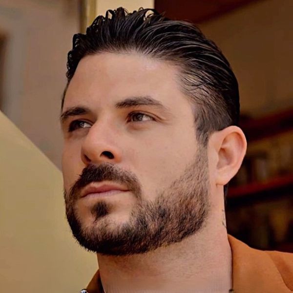Paul Antoine after hair transplant