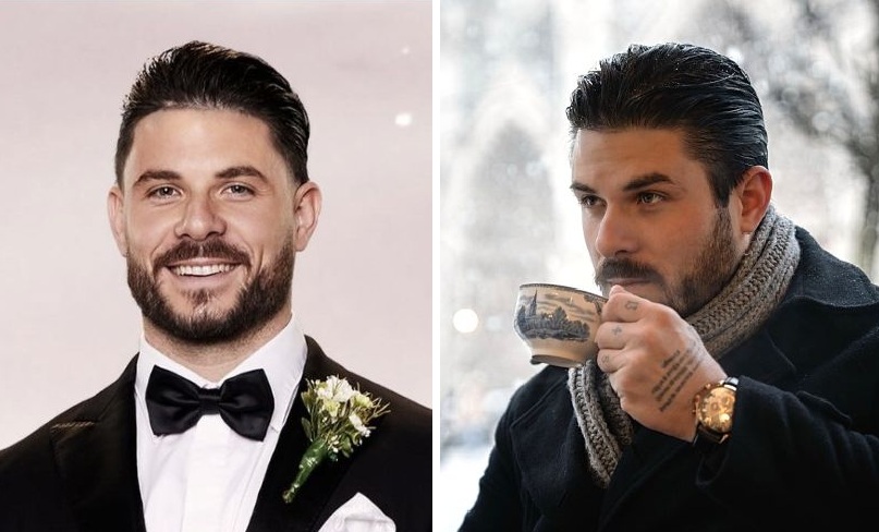Paul Mafs Hair Transplant