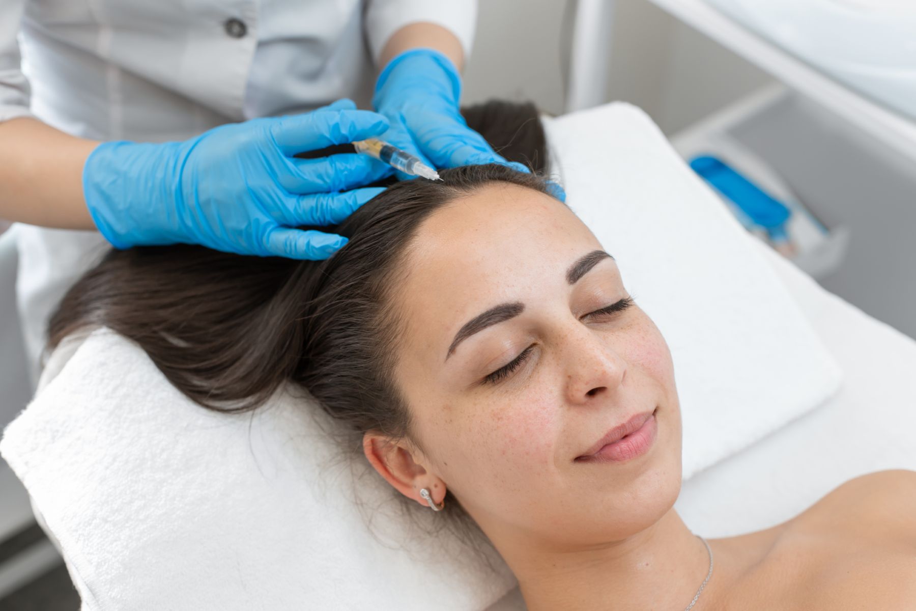 Women undergoing PRP therapy for hair loss