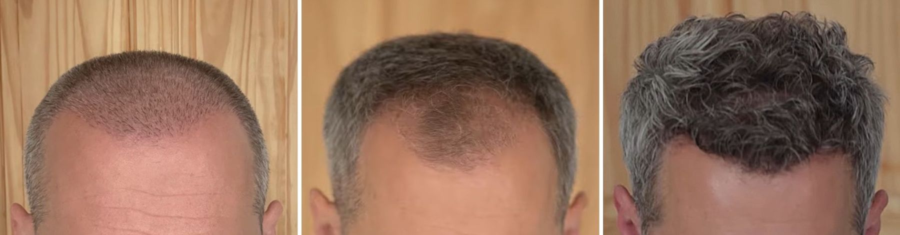 how long does it take for hair to grow back