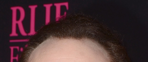 Close up of Nicolas Cage’s hairline (2018)
