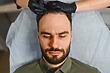 Forehead Reduction