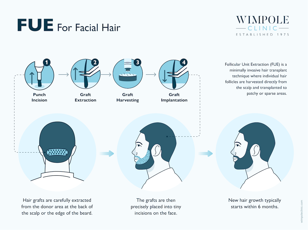 Conor Benn’s Beard Transplant: Results & Reaction, Wimpole Clinic