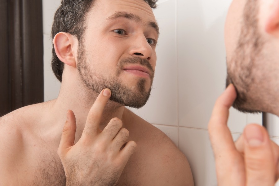 Beard Transplant Turkey Featured Image
