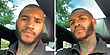 Beard Transplant