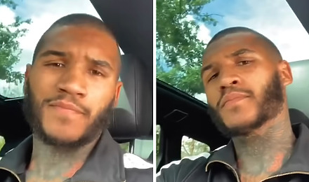 Conor Benn After Hair Transplant
