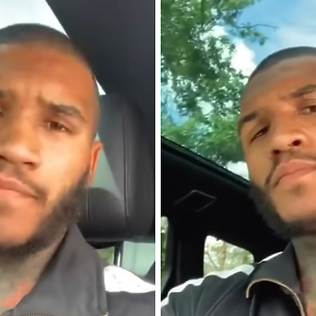 conor benn after hair transplant