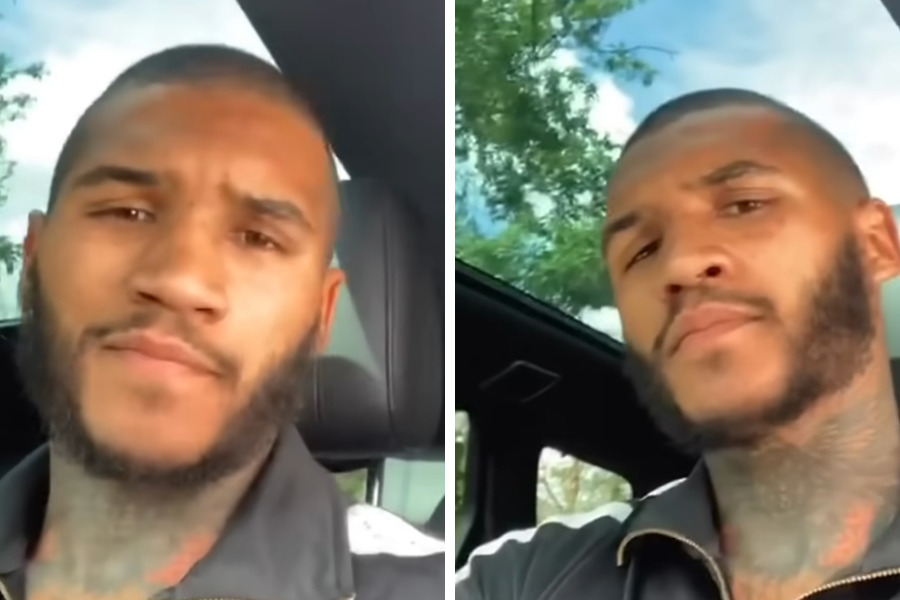 Conor Benn After Hair Transplant