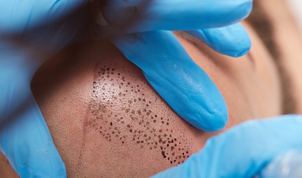 Hairline Tattoo Featured Image