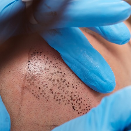 hairline tattoo featured image