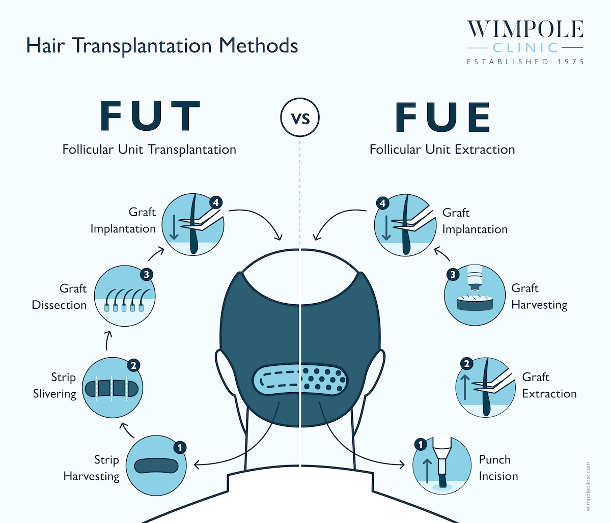 Tyga’s Hair Transplant: Results, Costs & Photo Analysis, Wimpole Clinic