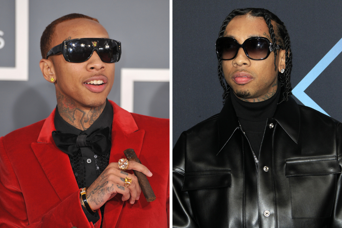 Left: Tyga’s hairline in 2012. Right: Tyga’s post-transplant hairline in 2018.